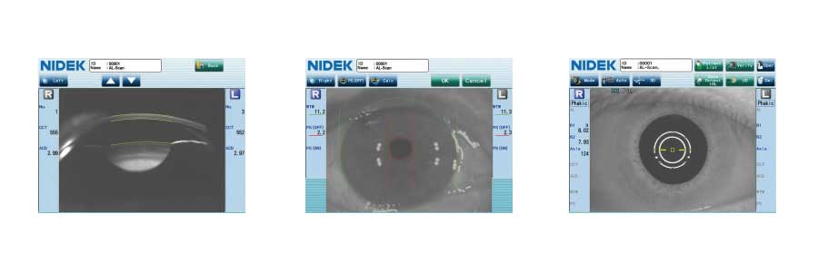 Nidek - AL - Scan Biometer